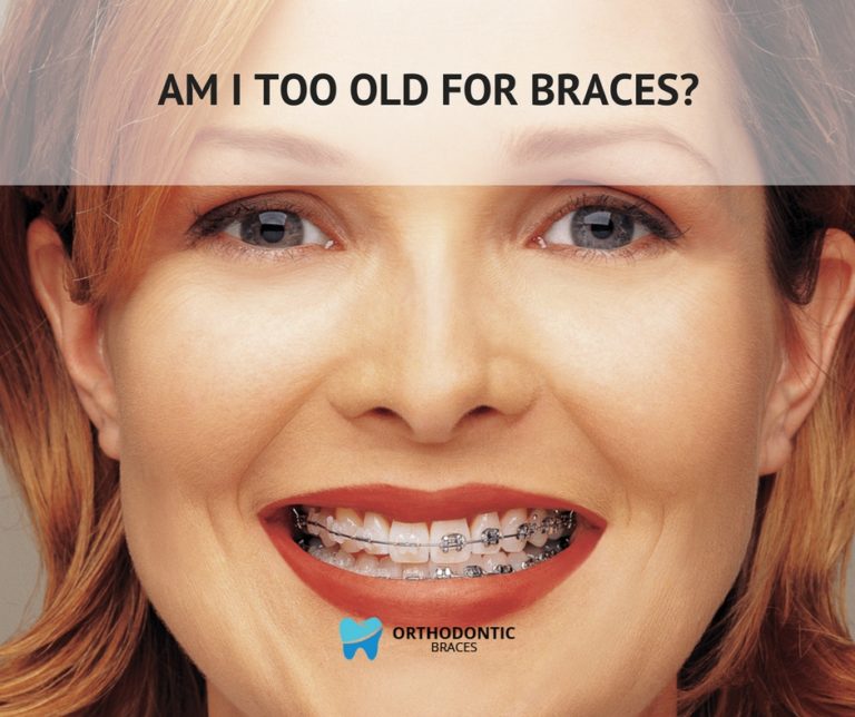 Am I Too Old For Braces Orthodontic Braces 